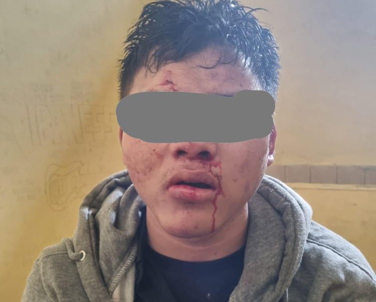 Sempat Dihakimi Warga, Pencuri Motor di Ciomas Bogor Diamankan Polisi