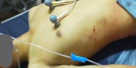 Tewasnya Pelajar Akibat Tawuran di Tanjungsari Bogor, Polisi Gelar TKP